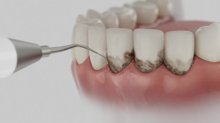 Reliable Emergency Dentist contractor in Bradner, OH by Smile Center Dentistry